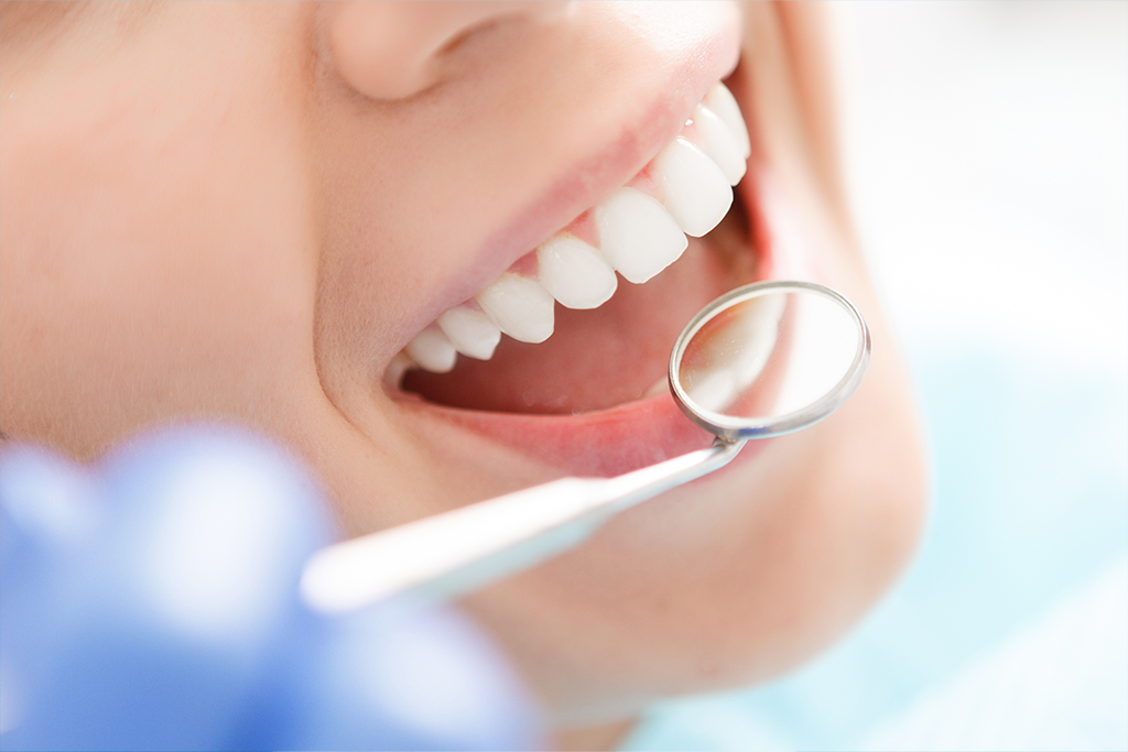Zahnreinigung Bremen – Nahaufnahme eines gesunden Mundes